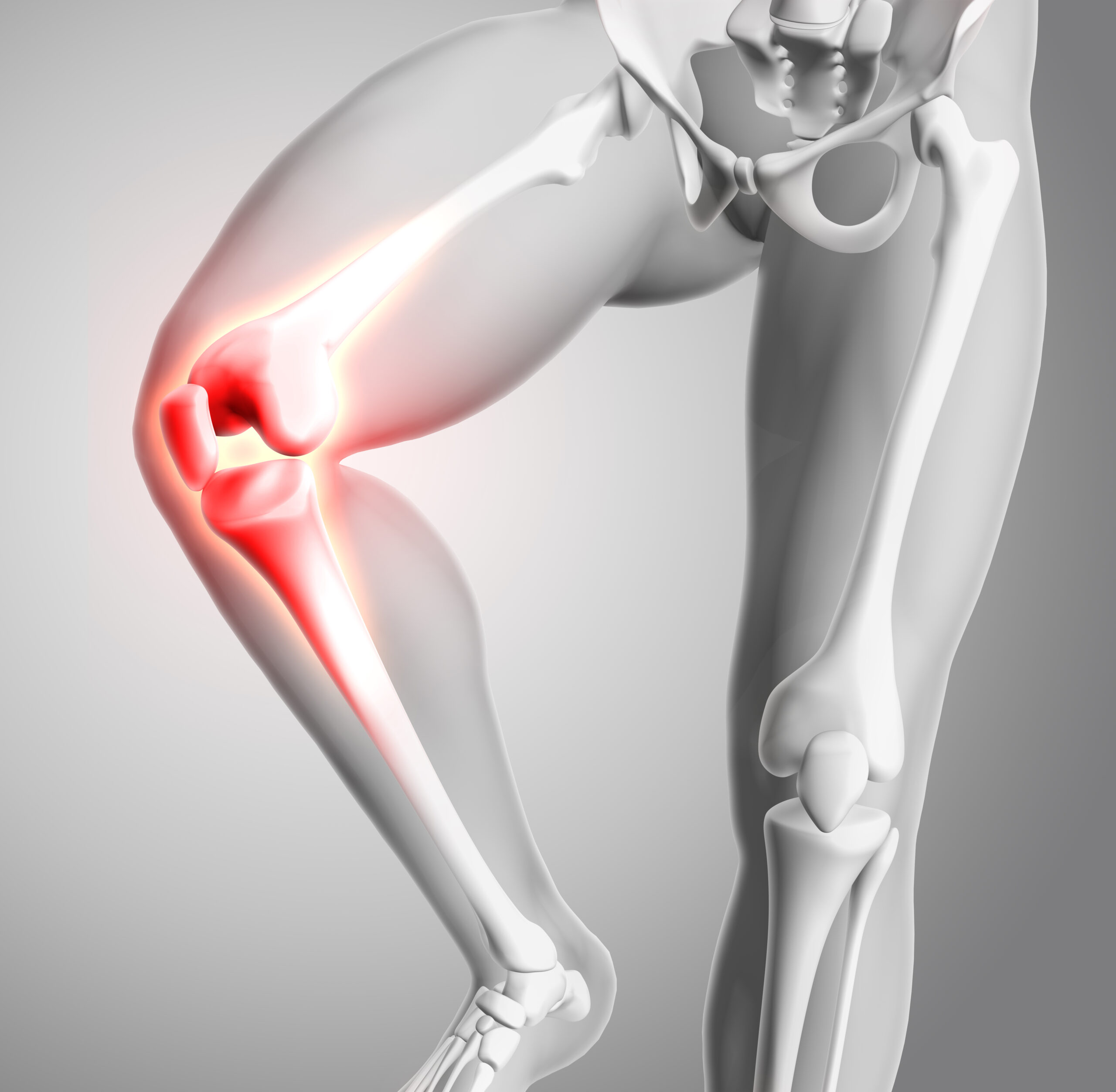 Beste oefeningen bij beginnende artrose knie